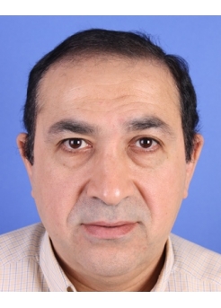 Before Hair Transplant&nbsp;Front